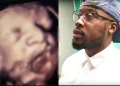 Husband thought his wife is having a baby, ‘fainted when the doctors told him what it is