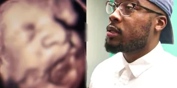 Husband thought his wife is having a baby, ‘fainted when the doctors told him what it is