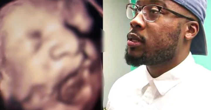 Husband thought his wife is having a baby, ‘fainted when the doctors told him what it is