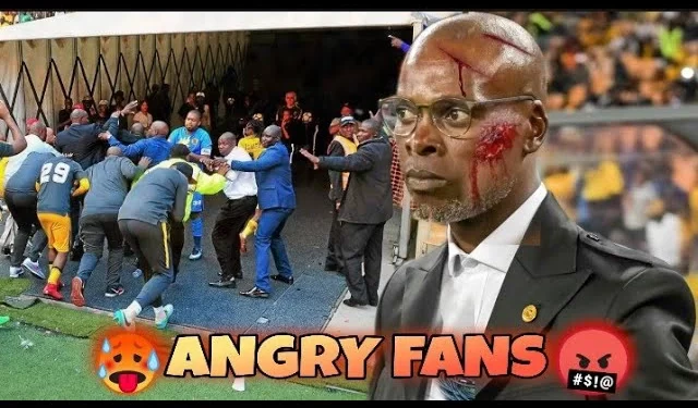 Arthur Zwane Injured by Chief Supporters