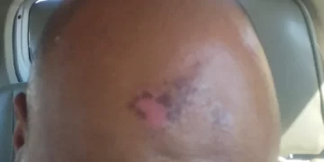 “They Should be Charged For Attempted Murder” – Victim is VIP Protection Unit Brutality Says