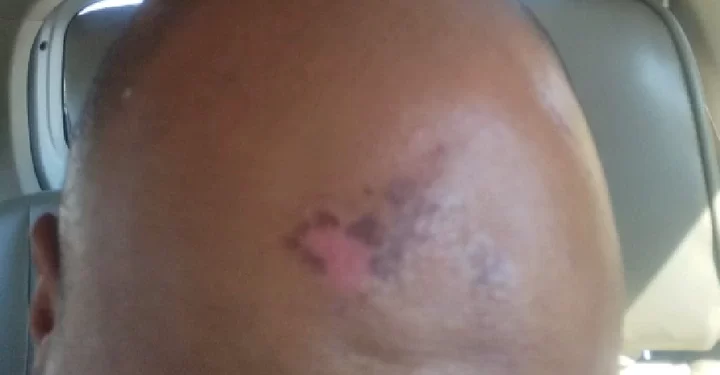 “They Should be Charged For Attempted Murder” – Victim is VIP Protection Unit Brutality Says