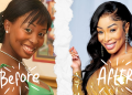 South African Celebrities Are Embracing Their Plastic Surgery Transformations