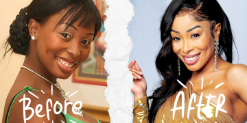South African Celebrities Are Embracing Their Plastic Surgery Transformations