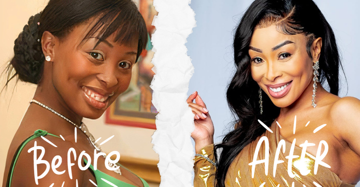 South African Celebrities Are Embracing Their Plastic Surgery Transformations