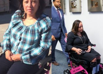 Fully qualified professional nurse is allegedly paralyzed afternoon doing a BBL