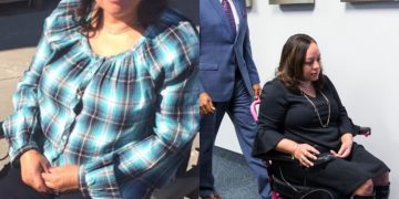 Fully qualified professional nurse is allegedly paralyzed afternoon doing a BBL