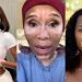 Meet the top female celebrities who have vitiligo on their face