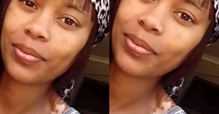 PAINFUL: She ran into her friend’s house to escape the gunshots from a gang but this happened to her