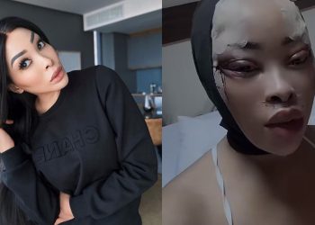 khanyi Mbau Ridiculed After Going Under The Knife For A New Face