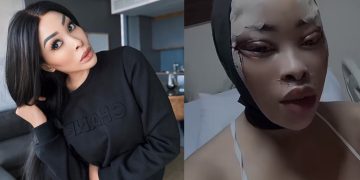 khanyi Mbau Ridiculed After Going Under The Knife For A New Face