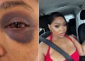 Sne Mthembu Accuses Boyfriend Andile Junior of Assault, Says Police Have Not Investigated