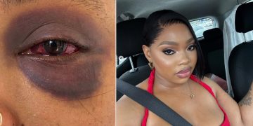 Sne Mthembu Accuses Boyfriend Andile Junior of Assault, Says Police Have Not Investigated