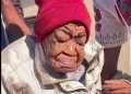31-Year-Old Woman Ages Rapidly to Look 95 After Encounter with Foreign Partner